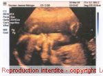 le 30 mars 2004  22 semaines + 6 jours