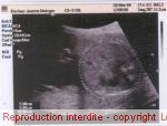 Abdomen : diamtre 60 mm - primtre 188 mm